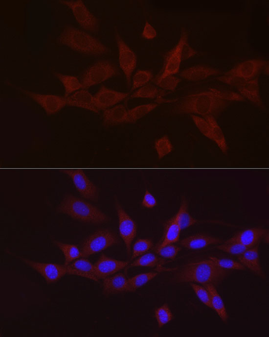 Immunocytochemistry/ Immunofluorescence: GnRH Antibody [NBP3-38172] - Immunofluorescence analysis of NIH/3T3 cells using GnRH Rabbit pAb at dilution of 1:50 (40x lens). Blue: DAPI for nuclear staining.