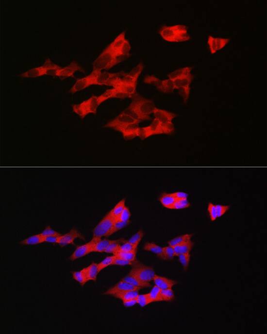 Immunocytochemistry/ Immunofluorescence: GnRH Antibody [NBP3-38172] - Immunofluorescence analysis of SH-SY5Y cells using GnRH Rabbit pAb at dilution of 1:200 (40x lens). Secondary antibody: Cy3-conjugated Goat anti-Rabbit IgG (H+L) at 1:500 dilution. Blue: DAPI for nuclear staining.