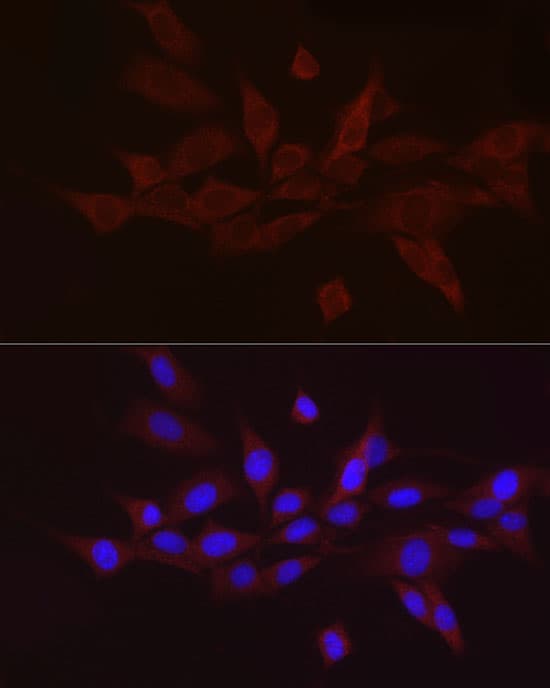 Immunocytochemistry/ Immunofluorescence GnRH Antibody