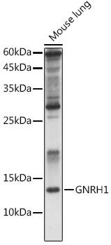 Western Blot: GnRH Antibody [NBP3-38172] - Western blot analysis of lysates from Rat kidney, using GnRH Rabbit pAb at 1:1000 dilution.&lt;br/&gt;Secondary antibody: HRP-conjugated Goat anti-Rabbit IgG (H+L) at 1:10000 dilution.&lt;br/&gt;Lysates/proteins: 25ug per lane.&lt;br/&gt;Blocking buffer: 3% nonfat dry milk in TBST.&lt;br/&gt;Detection: ECL Enhanced Kit.&lt;br/&gt;Exposure time: 60s.