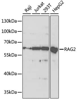 Western Blot: RAG2 Antibody [NBP3-38173] - Western blot analysis of various lysates using [KO Validated] RAG2 Rabbit pAb at 1:1000 dilution.Secondary antibody: HRP-conjugated Goat anti-Rabbit IgG (H+L) at 1:10000 dilution.Lysates/proteins: 25ug per lane.Blocking buffer: 3% nonfat dry milk in TBST.Detection: ECL Basic Kit.Exposure time: 90s.