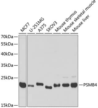 Western Blot: Proteasome subunit beta type 4 Antibody [NBP3-38174] - Western blot analysis of various lysates using Proteasome subunit beta type 4 Rabbit pAb at 1:1000 dilution.Secondary antibody: HRP-conjugated Goat anti-Rabbit IgG (H+L) at 1:10000 dilution.Lysates/proteins: 25ug per lane.Blocking buffer: 3% nonfat dry milk in TBST.Detection: ECL Basic Kit.Exposure time: 90s.