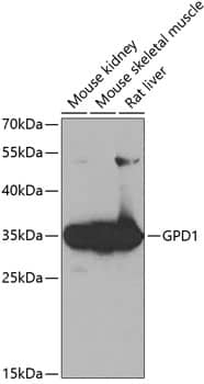 Western Blot: Glycerol 3 Phosphate Dehydrogenase Antibody [NBP3-38175] - Western blot analysis of various lysates using Glycerol 3 Phosphate Dehydrogenase Rabbit pAb at 1:1000 dilution.Secondary antibody: HRP-conjugated Goat anti-Rabbit IgG (H+L) at 1:10000 dilution.Lysates/proteins: 25ug per lane.Blocking buffer: 3% nonfat dry milk in TBST.Detection: ECL Basic Kit.Exposure time: 60s.