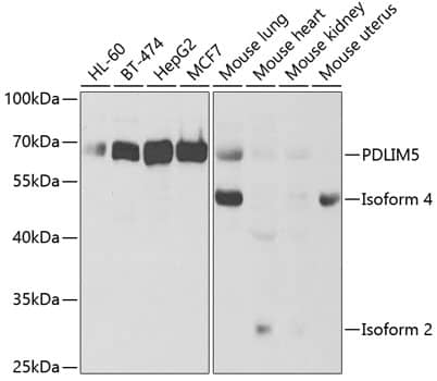 Western Blot: PDLIM5 Antibody [NBP3-38177] - Western blot analysis of various lysates using PDLIM5 Rabbit pAb at 1:1000 dilution.Secondary antibody: HRP-conjugated Goat anti-Rabbit IgG (H+L) at 1:10000 dilution.Lysates/proteins: 25ug per lane.Blocking buffer: 3% nonfat dry milk in TBST.