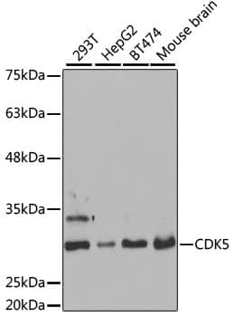 Western Blot: Cdk5 Antibody [NBP3-38178] - Western blot analysis of various lysates using [KO Validated] Cdk5 Rabbit pAb at 1:1000 dilution.Secondary antibody: HRP-conjugated Goat anti-Rabbit IgG (H+L) at 1:10000 dilution.Lysates/proteins: 25ug per lane.Blocking buffer: 3% nonfat dry milk in TBST.Detection: ECL Basic Kit.Exposure time: 30s.