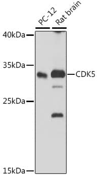 Western Blot: Cdk5 Antibody [NBP3-38178] - Western blot analysis of various lysates using [KO Validated] Cdk5 Rabbit pAb at 1:1000 dilution.Secondary antibody: HRP-conjugated Goat anti-Rabbit IgG (H+L) at 1:10000 dilution.Lysates/proteins: 25ug per lane.Blocking buffer: 3% nonfat dry milk in TBST.Detection: ECL Basic Kit.Exposure time: 90s.