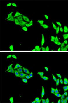 Immunocytochemistry/ Immunofluorescence: Cdk5 Antibody [NBP3-38178] - Immunofluorescence analysis of U2OS cells using [KO Validated] Cdk5 Rabbit pAb. Secondary antibody: Cy3-conjugated Goat anti-Rabbit IgG (H+L) at 1:500 dilution. Blue: DAPI for nuclear staining.