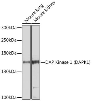 Western Blot: DAP Kinase 1 Antibody [NBP3-38180] - Western blot analysis of various lysates using DAP Kinase 1(DAPK1) Rabbit pAb at 1:1000 dilution.Secondary antibody: HRP-conjugated Goat anti-Rabbit IgG (H+L) at 1:10000 dilution.Lysates/proteins: 25ug per lane.Blocking buffer: 3% nonfat dry milk in TBST.Detection: ECL Enhanced Kit.Exposure time: 30s.