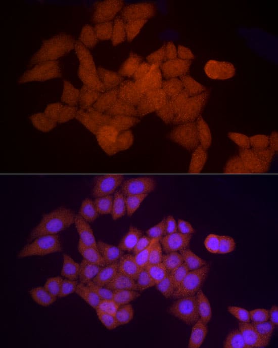 Immunocytochemistry/ Immunofluorescence: Proteasome 20S alpha 5 Antibody [NBP3-38181] - Immunofluorescence analysis of HeLa cells using Proteasome 20S alpha 5 Rabbit pAb at dilution of 1:50 (40x lens). Secondary antibody: Cy3-conjugated Goat anti-Rabbit IgG (H+L) at 1:500 dilution. Blue: DAPI for nuclear staining.