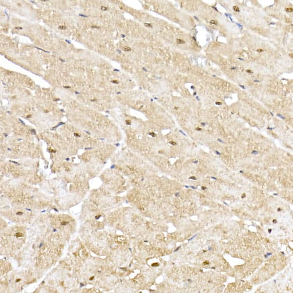 Immunohistochemistry: Proteasome 20S alpha 5 Antibody [NBP3-38181] - Immunohistochemistry analysis of paraffin-embedded Rat heart using Proteasome 20S alpha 5 Rabbit pAb at dilution of 1:50 (40x lens). High pressure antigen retrieval performed with 0.01M Citrate Bufferr (pH 6.0) prior to IHC staining.