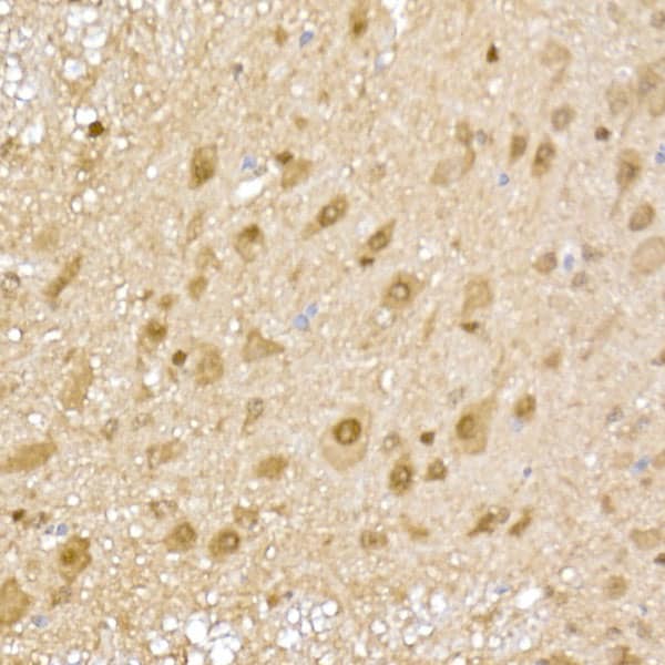 Immunohistochemistry: Proteasome 20S alpha 5 Antibody [NBP3-38181] - Immunohistochemistry analysis of paraffin-embedded Mouse spinal cord using Proteasome 20S alpha 5 Rabbit pAb at dilution of 1:50 (40x lens). High pressure antigen retrieval performed with 0.01M Citrate Bufferr (pH 6.0) prior to IHC staining.