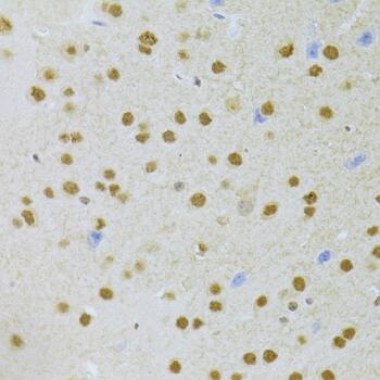 Immunohistochemistry: ANP32A Antibody [NBP3-38183] - Immunohistochemistry analysis of paraffin-embedded Mouse brain using ANP32A Rabbit pAb at dilution of 1:100 (40x lens). Microwave antigen retrieval performed with 0.01M PBS Buffer (pH 7.2) prior to IHC staining.