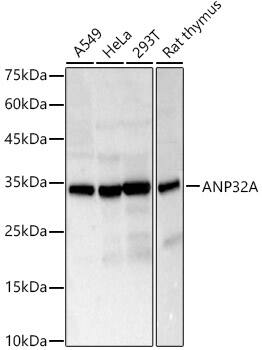 Western Blot: ANP32A Antibody [NBP3-38183] - Western blot analysis of various lysates, using ANP32A Rabbit pAb at 1:2000 dilution.Secondary antibody: HRP-conjugated Goat anti-Rabbit IgG (H+L) at 1:10000 dilution.Lysates/proteins: 25ug per lane.Blocking buffer: 3% nonfat dry milk in TBST.Detection: ECL Basic Kit.Exposure time: 10s.