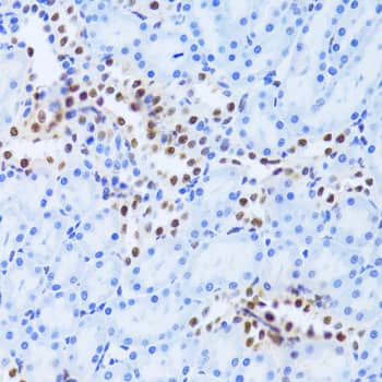 Immunohistochemistry: ANP32A Antibody [NBP3-38183] - Immunohistochemistry analysis of paraffin-embedded Rat kidney using ANP32A Rabbit pAb at dilution of 1:100 (40x lens). Microwave antigen retrieval performed with 0.01M PBS Buffer (pH 7.2) prior to IHC staining.