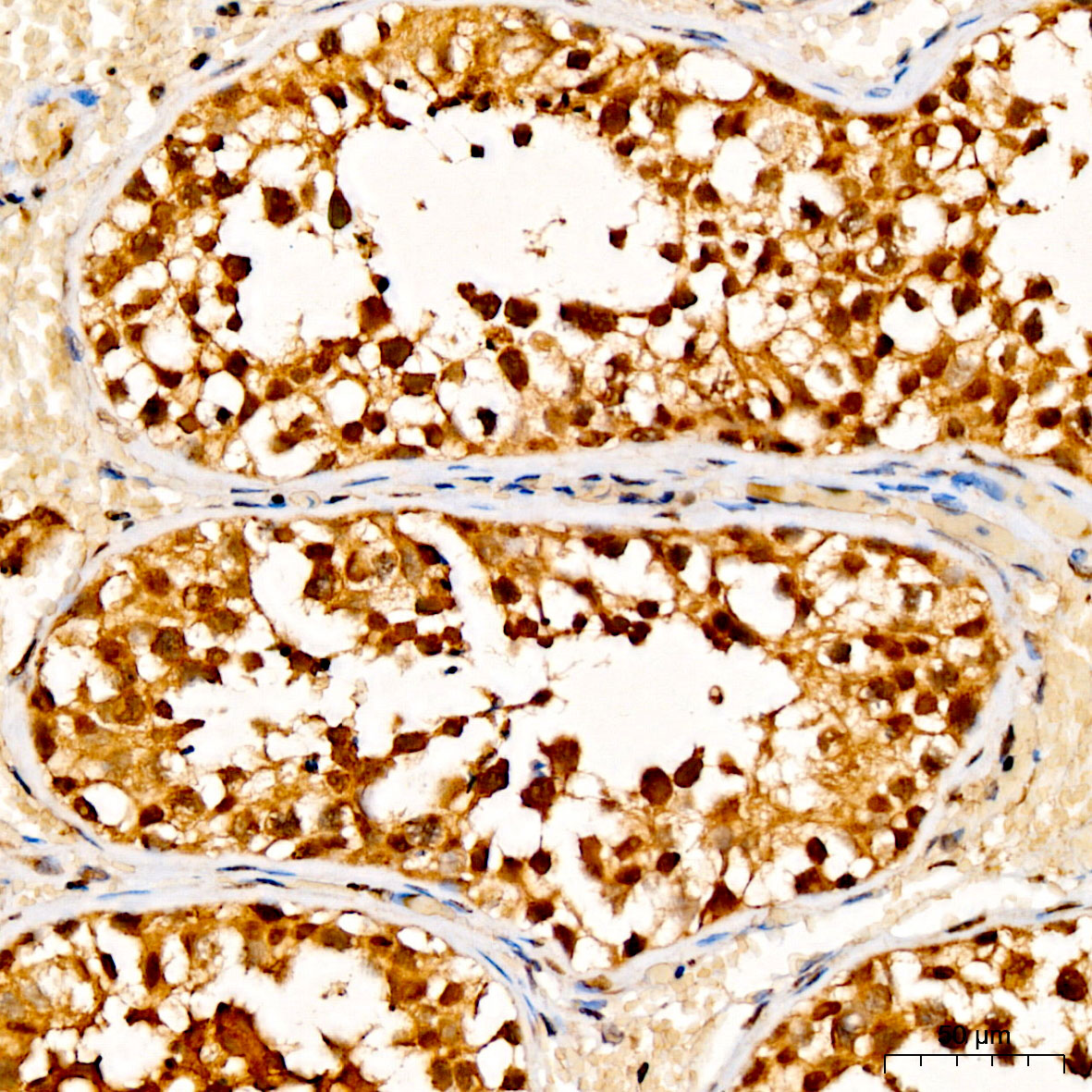 Immunohistochemistry: GSTO2 Antibody [NBP3-38184] - Immunohistochemistry analysis of GSTO2 in paraffin-embedded Human testis tissue using GSTO2 Rabbit pAb at a dilution of 1:100 (40x lens). High pressure antigen retrieval was performed with 0.01 M citrate buffer (pH 6.0) prior to IHC staining.