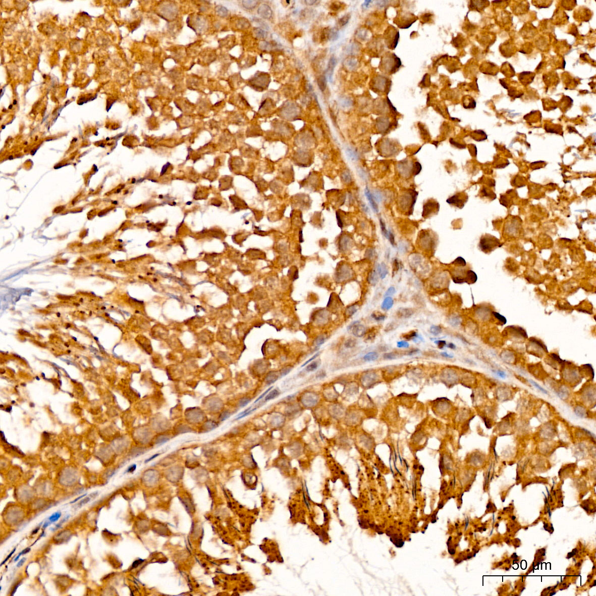 Immunohistochemistry: GSTO2 Antibody [NBP3-38184] - Immunohistochemistry analysis of GSTO2 in paraffin-embedded Rat testis tissue using GSTO2 Rabbit pAb at a dilution of 1:100 (40x lens). High pressure antigen retrieval was performed with 0.01 M citrate buffer (pH 6.0) prior to IHC staining.