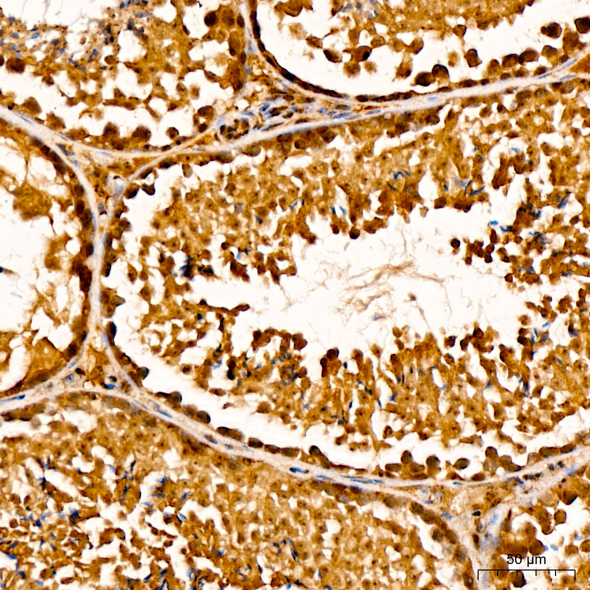Immunohistochemistry: GSTO2 Antibody [NBP3-38184] - Immunohistochemistry analysis of GSTO2 in paraffin-embedded Mouse testis tissue using GSTO2 Rabbit pAb at a dilution of 1:100 (40x lens). High pressure antigen retrieval was performed with 0.01 M citrate buffer (pH 6.0) prior to IHC staining.