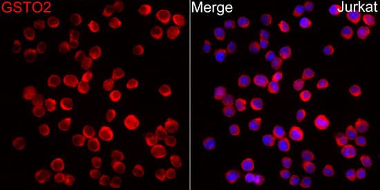 Immunohistochemistry GSTO2 Antibody