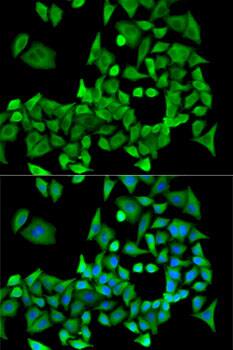Immunocytochemistry/ Immunofluorescence: PPP2R1A Antibody [NBP3-38186] - Immunofluorescence analysis of U2OS cells using PPP2R1A Rabbit pAb. Secondary antibody: Cy3-conjugated Goat anti-Rabbit IgG (H+L) at 1:500 dilution. Blue: DAPI for nuclear staining.