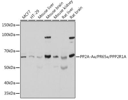 Western Blot: PPP2R1A Antibody [NBP3-38186] - Western blot analysis of various lysates using PPP2R1A Rabbit pAb at 1:500 dilution.Secondary antibody: HRP-conjugated Goat anti-Rabbit IgG (H+L) at 1:10000 dilution.Lysates/proteins: 25ug per lane.Blocking buffer: 3% nonfat dry milk in TBST.Detection: ECL Basic Kit.Exposure time: 1s.