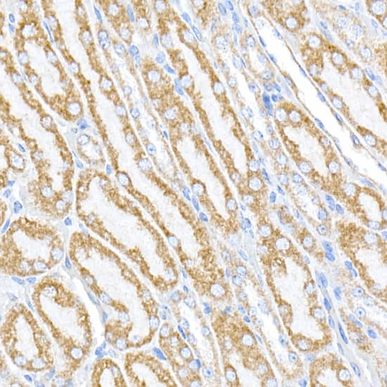 Immunohistochemistry: PTPIP51 Antibody [NBP3-38189] - Immunohistochemistry analysis of paraffin-embedded Mouse kidney using PTPIP51 Rabbit pAb at dilution of 1:100 (40x lens). High pressure antigen retrieval performed with 0.01M Citrate Bufferr (pH 6.0) prior to IHC staining.
