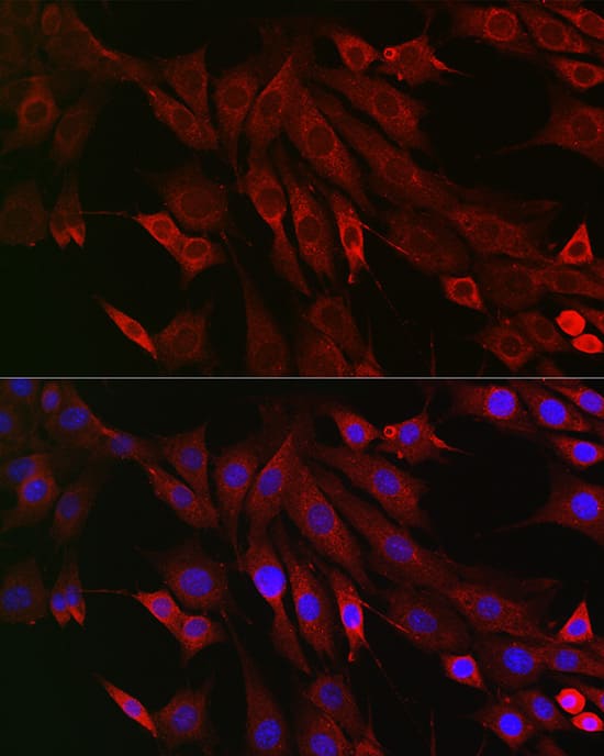 Immunocytochemistry/ Immunofluorescence: PTPIP51 Antibody [NBP3-38189] - Immunofluorescence analysis of NIH/3T3 cells using PTPIP51 Rabbit pAb at dilution of 1:200 (40x lens). Secondary antibody: Cy3-conjugated Goat anti-Rabbit IgG (H+L) at 1:500 dilution. Blue: DAPI for nuclear staining.