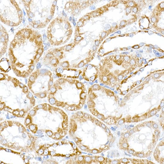 Immunohistochemistry: PTPIP51 Antibody [NBP3-38189] - Immunohistochemistry analysis of paraffin-embedded Rat kidney using PTPIP51 Rabbit pAb at dilution of 1:100 (40x lens). High pressure antigen retrieval performed with 0.01M Citrate Bufferr (pH 6.0) prior to IHC staining.