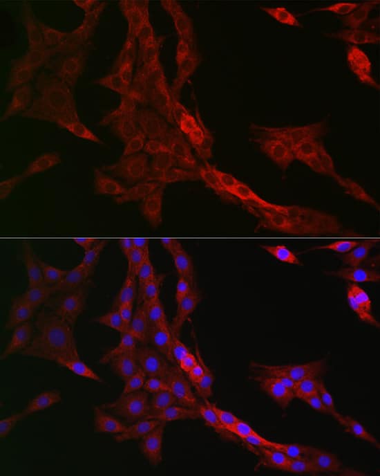 Immunocytochemistry/ Immunofluorescence: PTPIP51 Antibody [NBP3-38189] - Immunofluorescence analysis of PC-12 cells using PTPIP51 Rabbit pAb at dilution of 1:200 (40x lens). Secondary antibody: Cy3-conjugated Goat anti-Rabbit IgG (H+L) at 1:500 dilution. Blue: DAPI for nuclear staining.