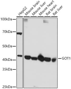 Western Blot: Aspartate Aminotransferase Antibody [NBP3-38190] - Western blot analysis of various lysates using Aspartate Aminotransferase Rabbit pAb at  1:1000 dilution.Secondary antibody: HRP-conjugated Goat anti-Rabbit IgG (H+L) at 1:10000 dilution.Lysates/proteins: 25ug per lane.Blocking buffer: 3% nonfat dry milk in TBST.Detection: ECL Basic Kit.Exposure time: 5s.