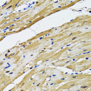 Immunohistochemistry: Aspartate Aminotransferase Antibody [NBP3-38190] - Immunohistochemistry analysis of paraffin-embedded Rat heart using Aspartate Aminotransferase Rabbit pAb at dilution of 1:100 (40x lens). Microwave antigen retrieval performed with 0.01M PBS Buffer (pH 7.2) prior to IHC staining.