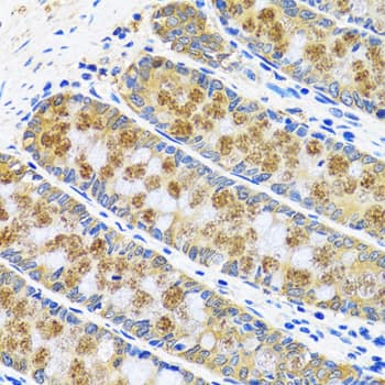 Immunohistochemistry: Aspartate Aminotransferase Antibody [NBP3-38190] - Immunohistochemistry analysis of paraffin-embedded Human colon using Aspartate Aminotransferase Rabbit pAb at dilution of 1:100 (40x lens). Microwave antigen retrieval performed with 0.01M PBS Buffer (pH 7.2) prior to IHC staining.