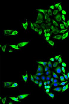 Immunocytochemistry/ Immunofluorescence: Aspartate Aminotransferase Antibody [NBP3-38190] - Immunofluorescence analysis of U2OS cells using Aspartate Aminotransferase Rabbit pAb. Secondary antibody: Cy3-conjugated Goat anti-Rabbit IgG (H+L) at 1:500 dilution. Blue: DAPI for nuclear staining.