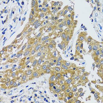 Immunohistochemistry Aspartate Aminotransferase Antibody