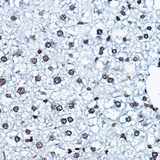 Immunohistochemistry HBO1 Antibody