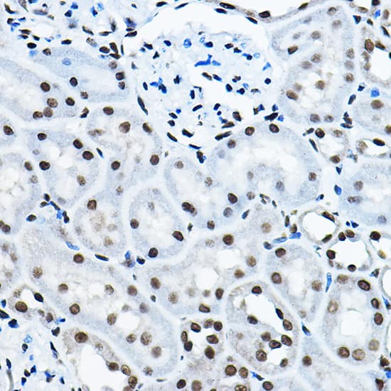 Immunohistochemistry HBO1 Antibody