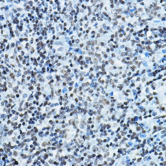 Immunohistochemistry HBO1 Antibody