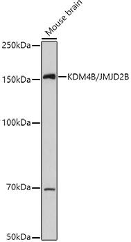 Western Blot: JMJD2B Antibody [NBP3-38192] - Western blot analysis of lysates from Mouse brain, using  at 1:1000 dilution.Secondary antibody: HRP-conjugated Goat anti-Rabbit IgG (H+L) at 1:10000 dilution.Lysates/proteins: 25μg per lane.Blocking buffer: 3% nonfat dry milk in TBST.Detection: ECL Basic Kit.Exposure time: 30s.