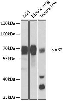 Western Blot: Nab2 Antibody [NBP3-38193] - Western blot analysis of various lysates using Nab2 Rabbit pAb at 1:1000 dilution.Secondary antibody: HRP-conjugated Goat anti-Rabbit IgG (H+L) at 1:10000 dilution.Lysates/proteins: 25ug per lane.Blocking buffer: 3% nonfat dry milk in TBST.Detection: ECL Basic Kit.Exposure time: 90s.