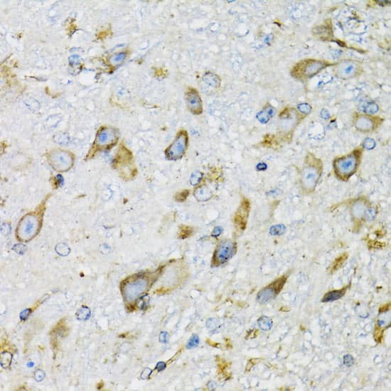 Immunohistochemistry: Prodynorphin/PDYN Antibody [NBP3-38195] - Immunohistochemistry analysis of paraffin-embedded Mouse brain using Prodynorphin/PDYN Rabbit pAb at dilution of 1:100 (40x lens). Microwave antigen retrieval performed with 0.01M PBS Buffer (pH 7.2) prior to IHC staining.