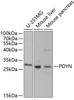 Western Blot: Prodynorphin/PDYN Antibody [NBP3-38195] - Western blot analysis of various lysates using Prodynorphin/PDYN Rabbit pAb at 1:1000 dilution.Secondary antibody: HRP-conjugated Goat anti-Rabbit IgG (H+L) at 1:10000 dilution.Lysates/proteins: 25ug per lane.Blocking buffer: 3% nonfat dry milk in TBST.Detection: ECL Basic Kit.Exposure time: 90s.