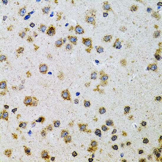 Immunohistochemistry: Prodynorphin/PDYN Antibody [NBP3-38195] - Immunohistochemistry analysis of paraffin-embedded Rat brain using Prodynorphin/PDYN Rabbit pAb at dilution of 1:100 (40x lens). Microwave antigen retrieval performed with 0.01M PBS Buffer (pH 7.2) prior to IHC staining.