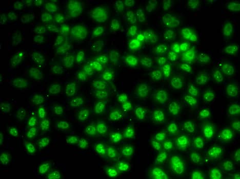 Immunocytochemistry/ Immunofluorescence: PRMT2 Antibody [NBP3-38197] - Immunofluorescence analysis of HeLa cells using [KO Validated] PRMT2 Rabbit pAb.Secondary antibody: Cy3-conjugated Goat anti-Rabbit IgG (H+L) at 1:500 dilution.