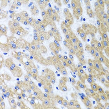 Immunohistochemistry: PRMT2 Antibody [NBP3-38197] - Immunohistochemistry analysis of paraffin-embedded Human liver damage using [KO Validated] PRMT2 Rabbit pAb at dilution of 1:100 (40x lens). Microwave antigen retrieval performed with 0.01M PBS Buffer (pH 7.2) prior to IHC staining.