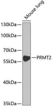 Western Blot: PRMT2 Antibody [NBP3-38197] - Western blot analysis of lysates from mouse lung, using [KO Validated] PRMT2 Rabbit pAb at 1:1000 dilution.Secondary antibody: HRP-conjugated Goat anti-Rabbit IgG (H+L) at 1:10000 dilution.Lysates/proteins: 25ug per lane.Blocking buffer: 3% nonfat dry milk in TBST.Detection: ECL Enhanced Kit.Exposure time: 90s.