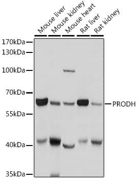 Western Blot: PRODH Antibody [NBP3-38198] - Western blot analysis of various lysates using PRODH Rabbit pAb at 1:1000 dilution.Secondary antibody: HRP-conjugated Goat anti-Rabbit IgG (H+L) at 1:10000 dilution.Lysates/proteins: 25ug per lane.Blocking buffer: 3% nonfat dry milk in TBST.Detection: ECL Basic Kit.Exposure time: 1s.