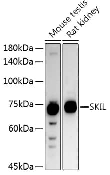 Western Blot: SnoN Antibody [NBP3-38200] - Western blot analysis of various lysates using SnoN Rabbit pAb at 1:1000 dilution.Secondary antibody: HRP-conjugated Goat anti-Rabbit IgG (H+L) at 1:10000 dilution.Lysates/proteins: 25ug per lane.Blocking buffer: 3% nonfat dry milk in TBST.Detection: ECL Basic Kit.Exposure time: 30s.