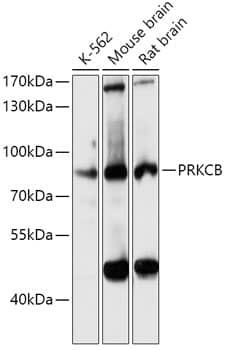 Western Blot: PKC beta Antibody [NBP3-38201] - Western blot analysis of various lysates using PKC beta Rabbit pAb at 1:3000 dilution.Secondary antibody: HRP-conjugated Goat anti-Rabbit IgG (H+L) at 1:10000 dilution.Lysates/proteins: 25ug per lane.Blocking buffer: 3% nonfat dry milk in TBST.Detection: ECL Basic Kit.Exposure time: 10s.