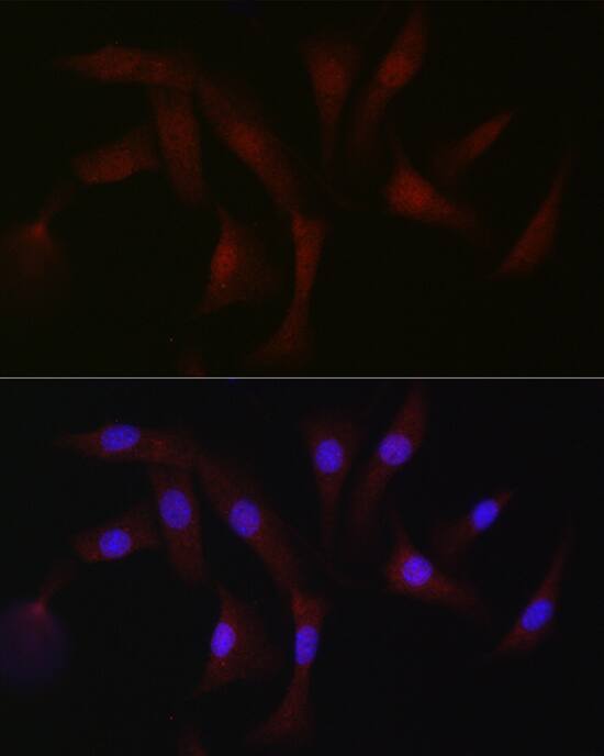 Immunocytochemistry/ Immunofluorescence PKC beta Antibody