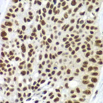 Immunohistochemistry SF3B2 Antibody