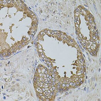 Immunohistochemistry: kinectin Antibody [NBP3-38206] - Immunohistochemistry analysis of paraffin-embedded Human prostate using kinectin Rabbit pAb at dilution of 1:100 (40x lens). Microwave antigen retrieval performed with 0.01M PBS Buffer (pH 7.2) prior to IHC staining.